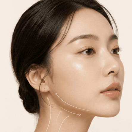 리프팅 대표 이미지